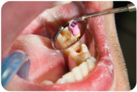 Endodontia (tratamento de canal)